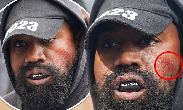 Kanye West sports mystery marks on his face and a Balenciaga mouth guard at Givenchy show during PFW