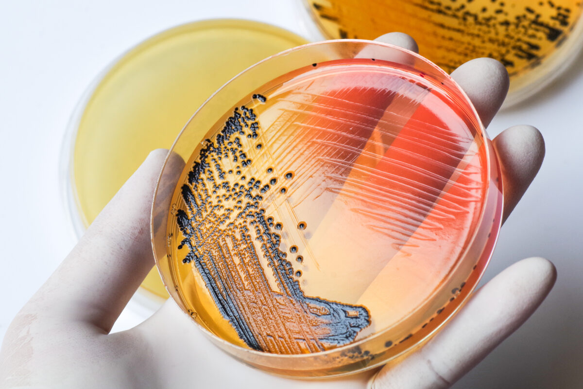 Salmonella Outbreak in Chicago Area Linked to Ground Beef